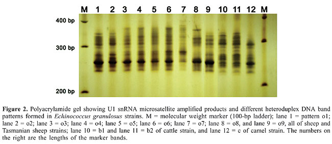 Dna+page+gel+electrophoresis